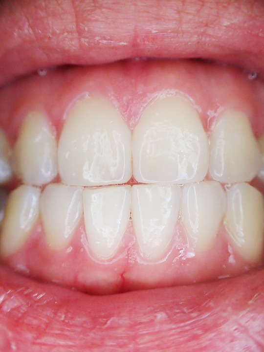 teeth-887338_960_720